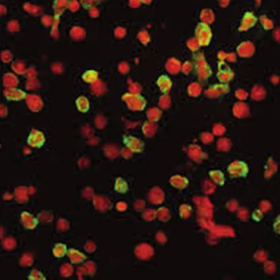 pneumoslide igm ifa test